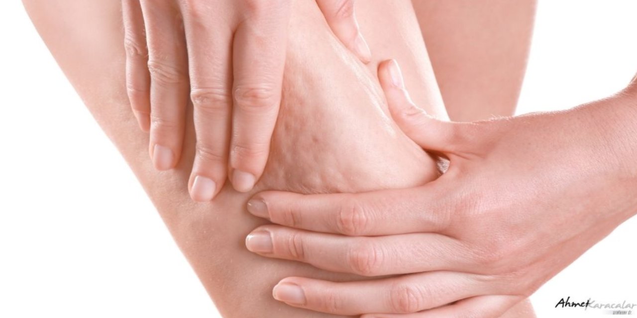 Prof. Dr. Ahmet Karacalar''selülit sadece selülit değildir metabolik bir aynadır''